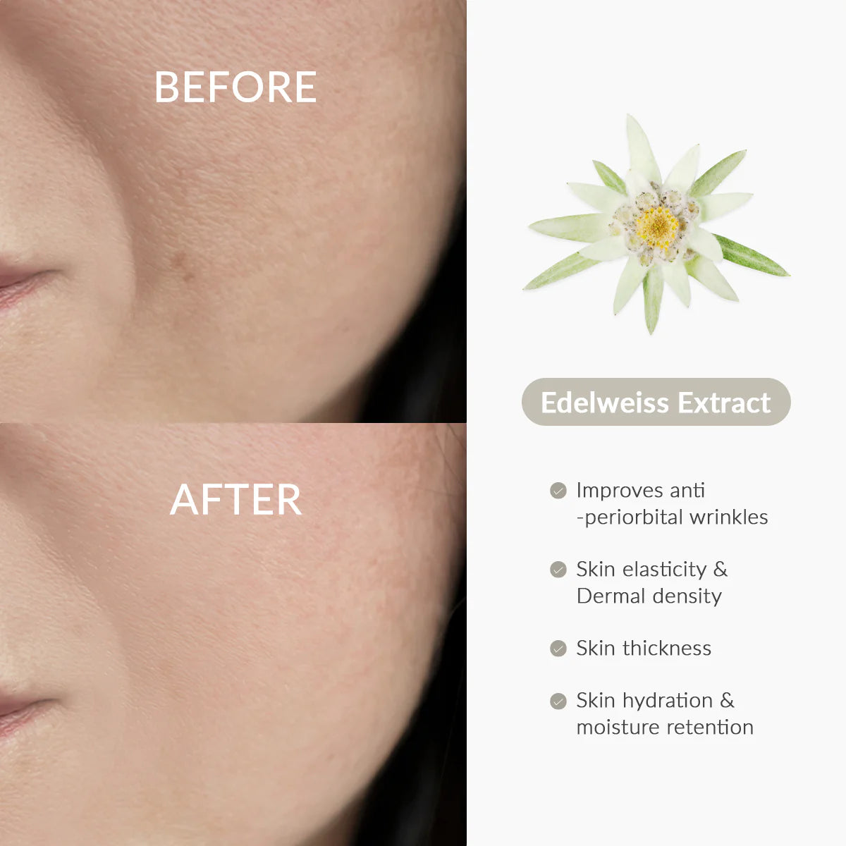 Cremă Anti-Aging cu Extract de Edelweiss