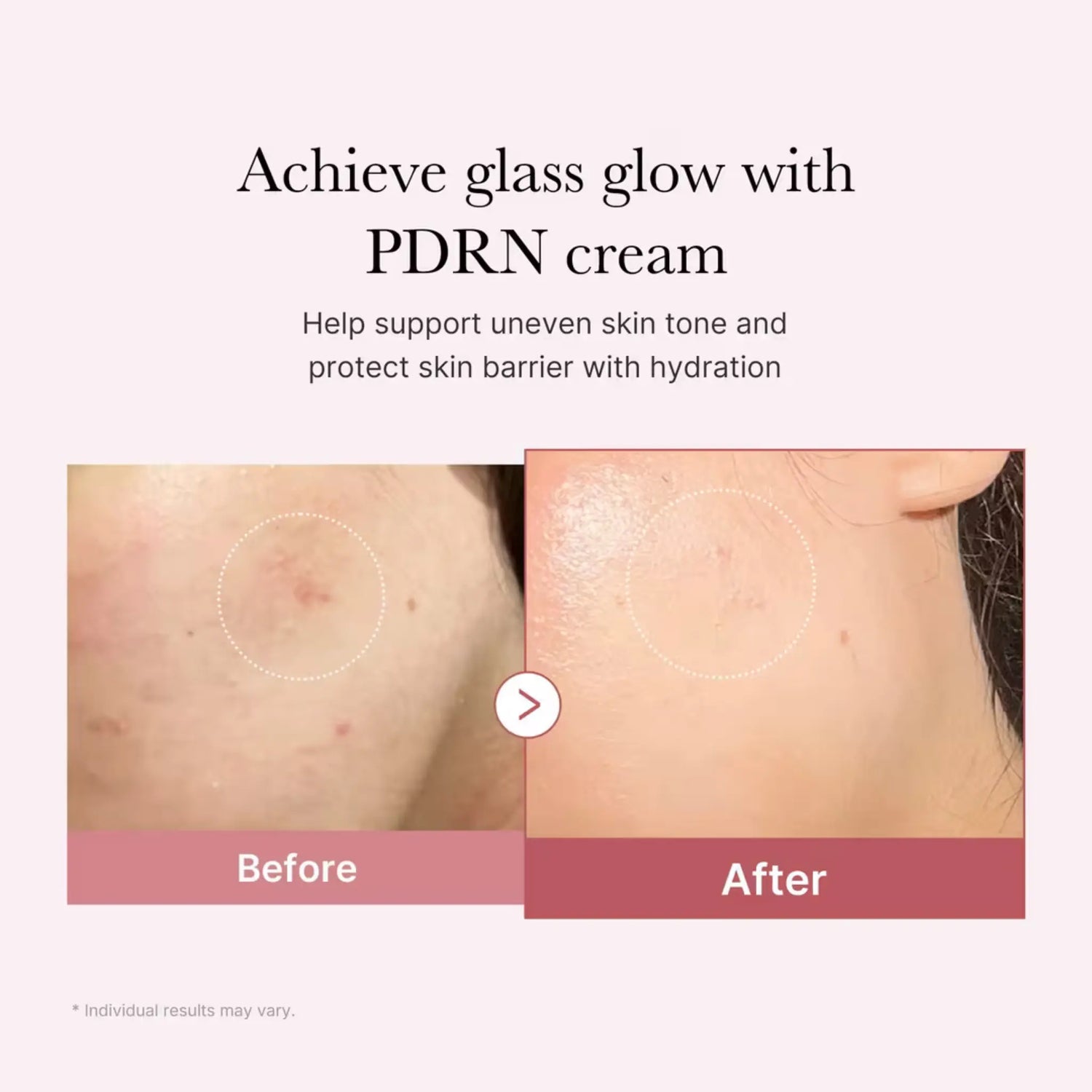PDRN Pink Hyaluronic Moisturizing Cream - Cremă Hidratantă cu PDRN din Somon și Acid Hialuronic