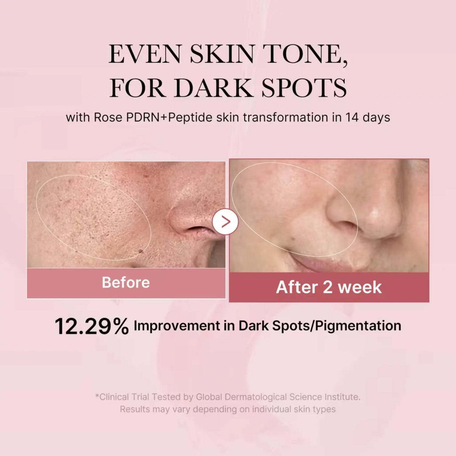 PDRN Pink Cica Soothing Toner - Toner Calm-antioxidant cu PDRN din Somon și 5 Peptide