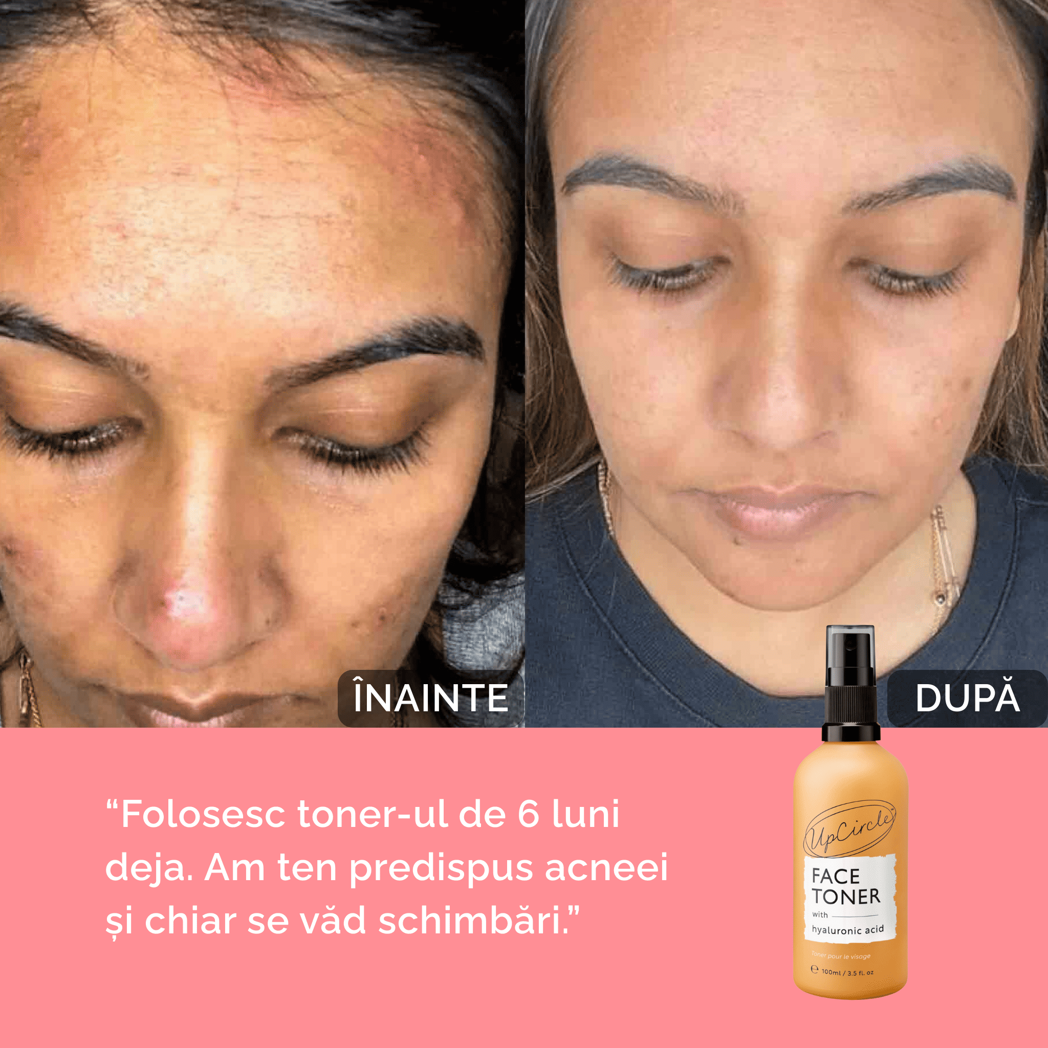 Toner Hidratant pentru Față cu Acid Hialuronic și Mușețel