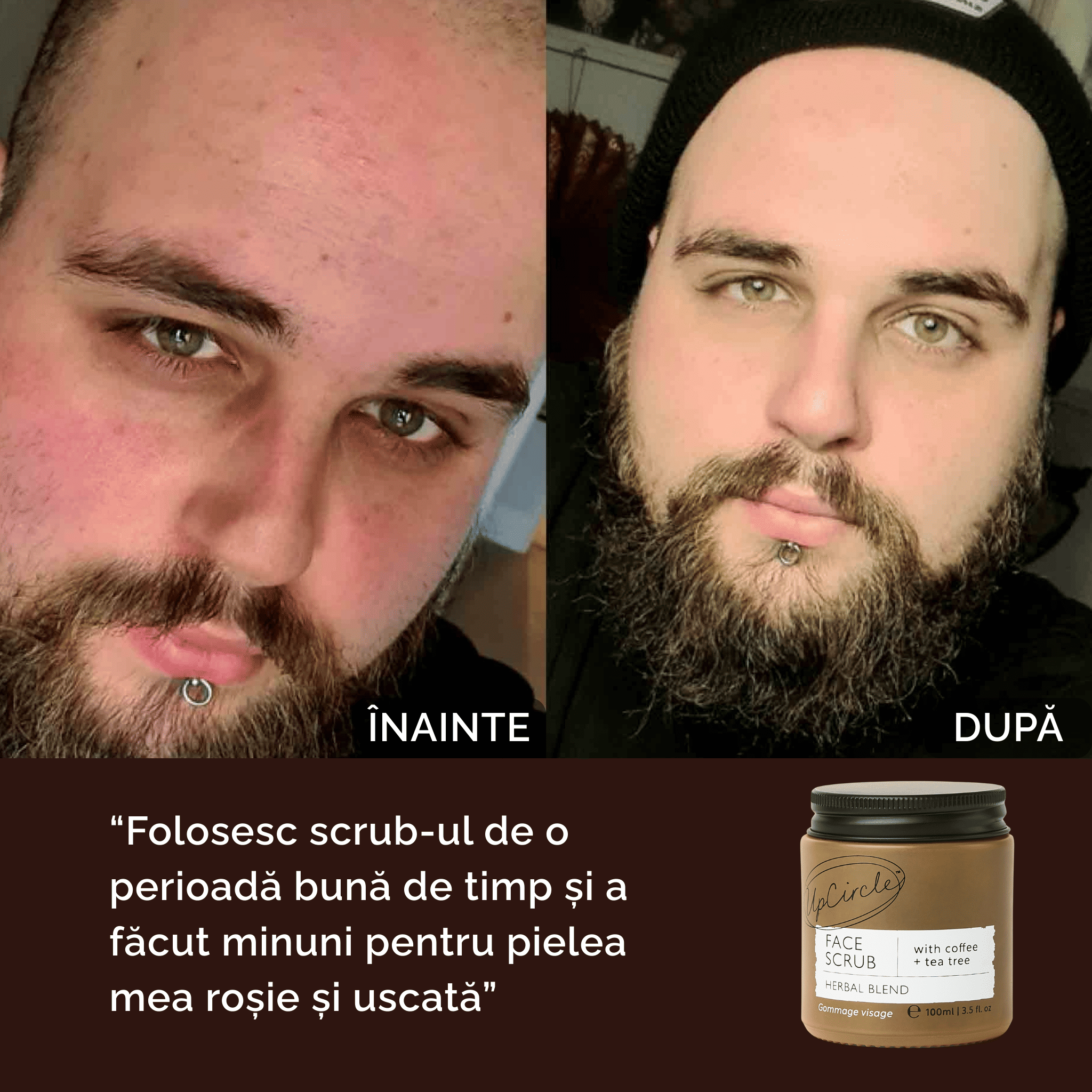 Scrub Exfoliant pentru Acnee cu Cafea și Ulei de Rozmarin