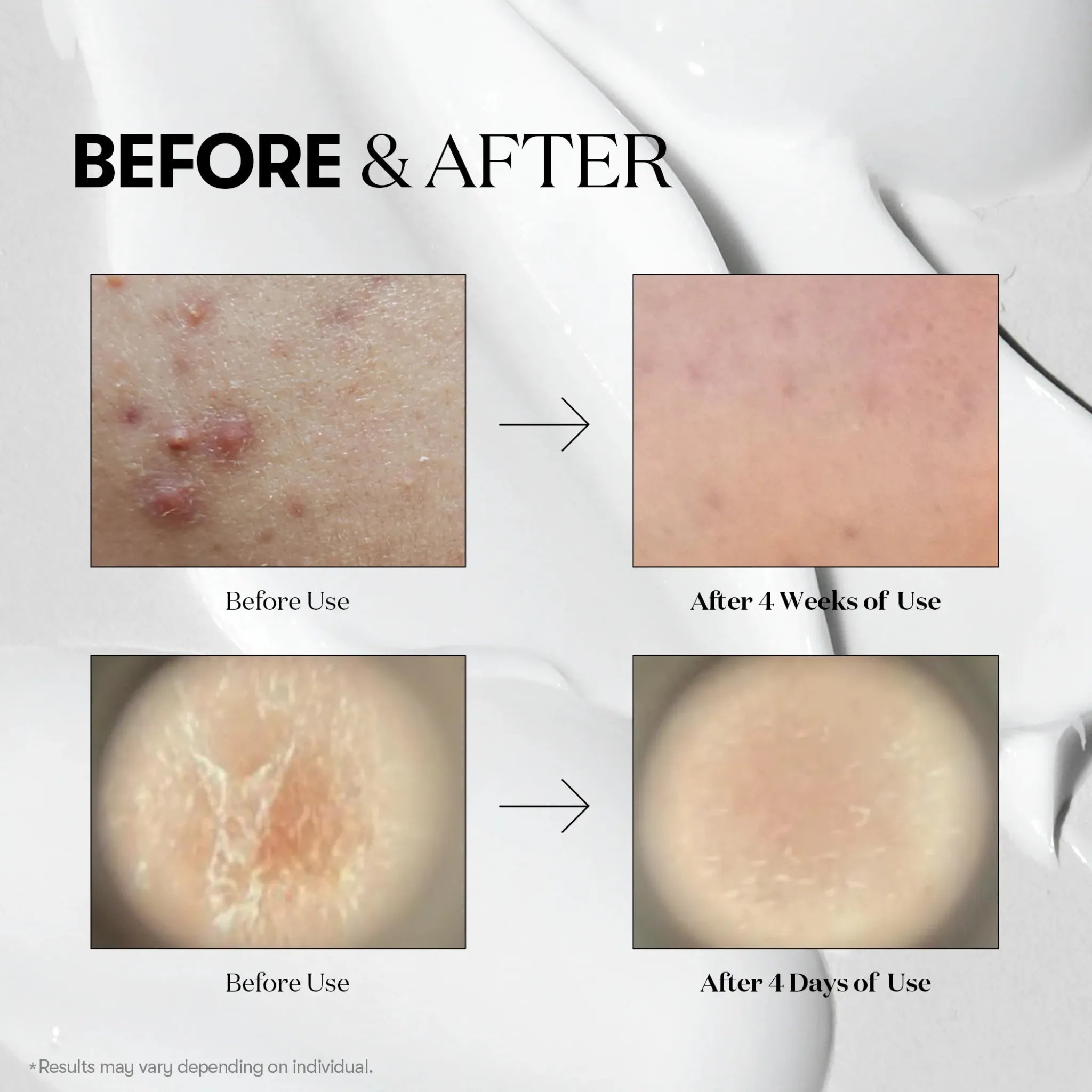 Reedle Shot 100 - Booster Exfoliant pentru Textură și Luminozitate