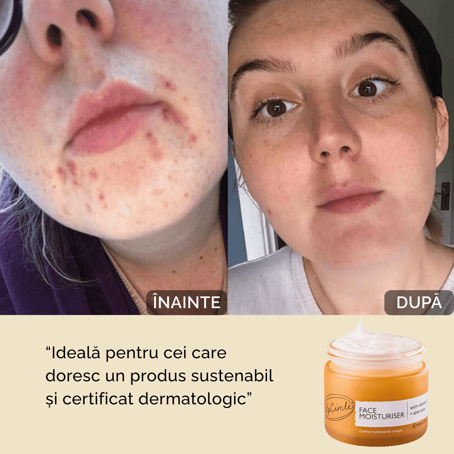 Set de Îngrijire Completă – Curățare, Tonifiere și Hidratare