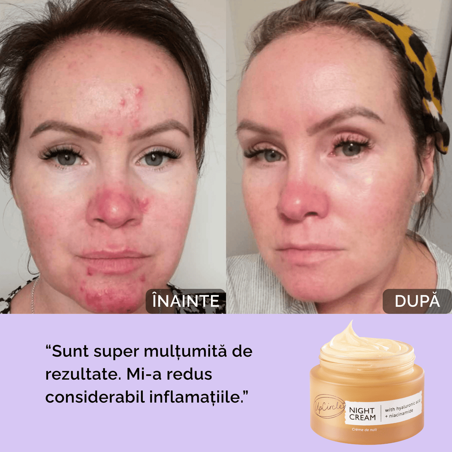 Cremă de Noapte Regenerantă cu Acid Hialuronic + Niacinamide