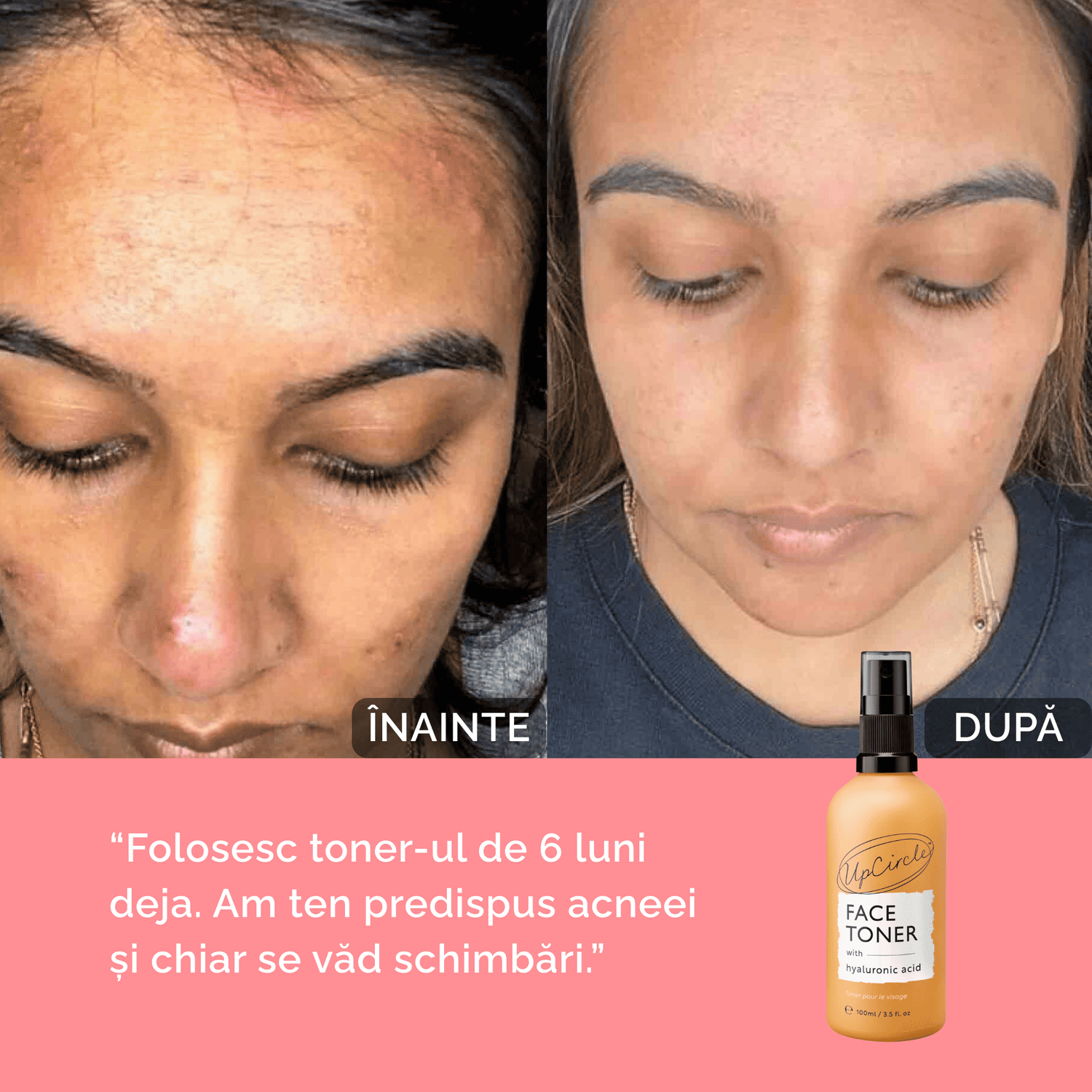 Set de Îngrijire Completă – Curățare, Tonifiere și Hidratare