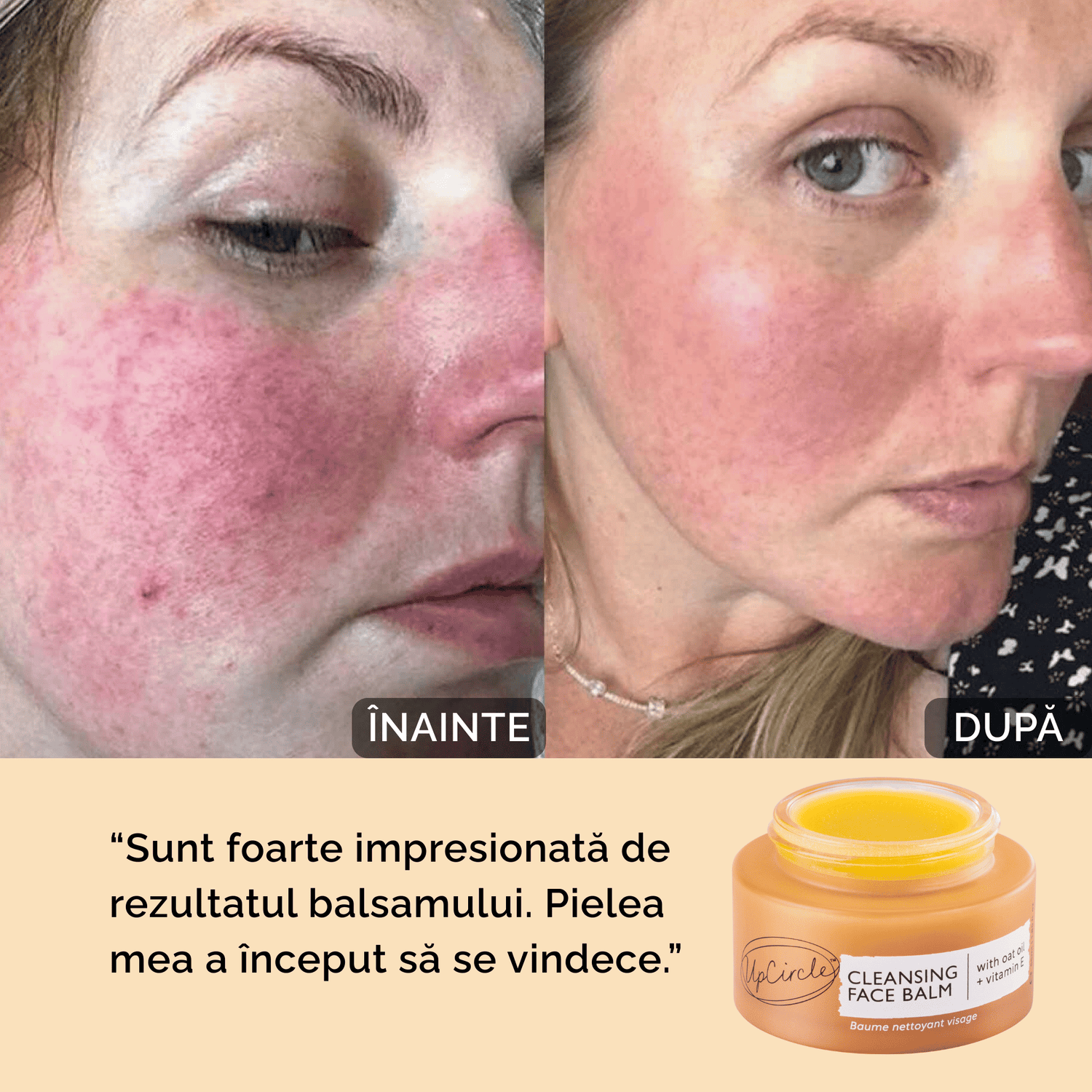 Balsam de Curățare pentru Față – Hidratare și Protecție cu Vitamina E
