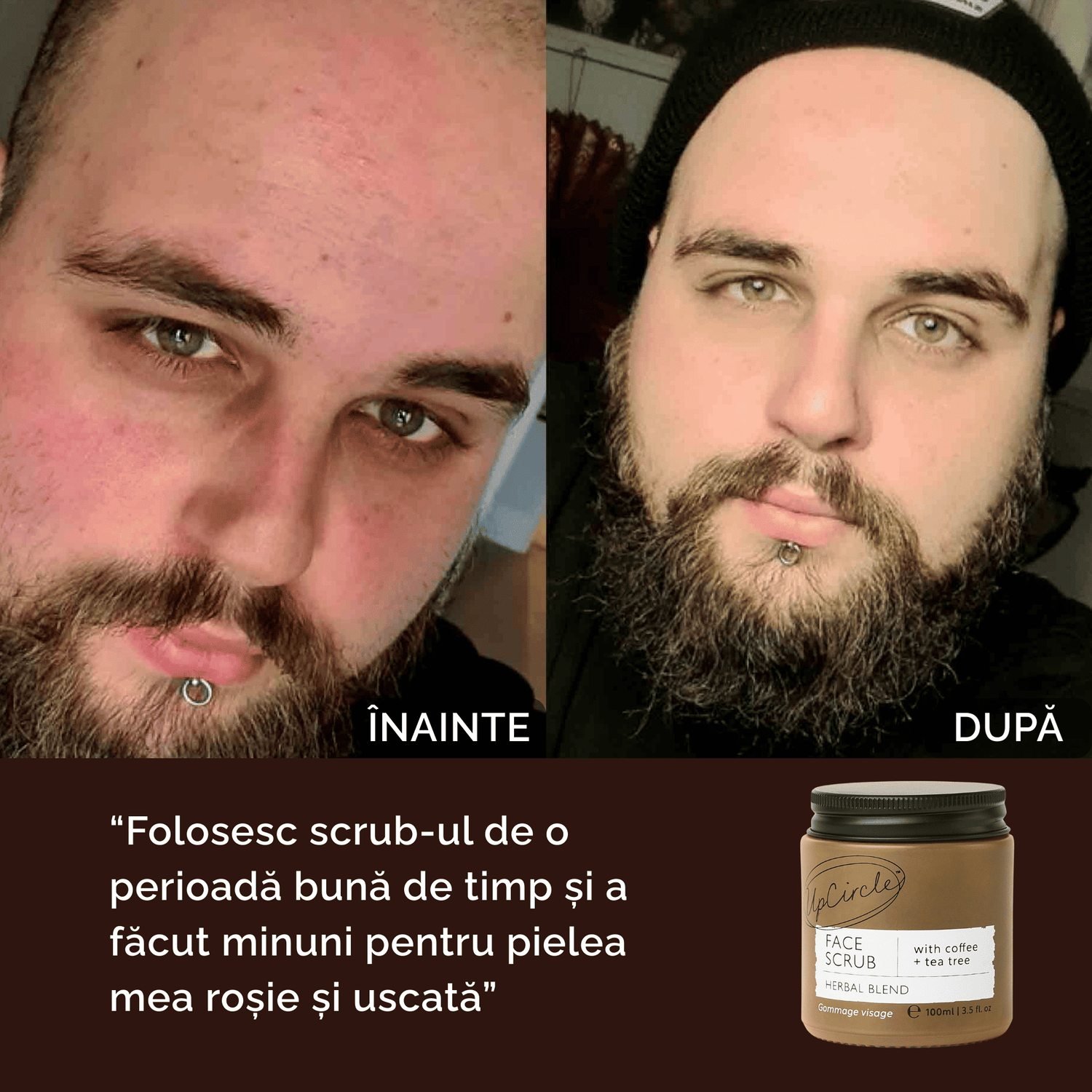 Scrub Exfoliant pentru Acnee cu Cafea și Ulei de Rozmarin